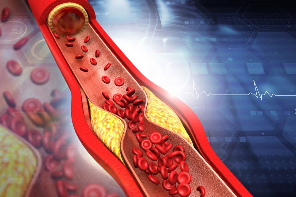 Nattokinase and Pine Bark Extract Promote Vascular Health